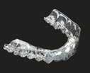 Orthodontic s strives for accuracy in all data but cannot be held responsible for claims made by manufacturers.
