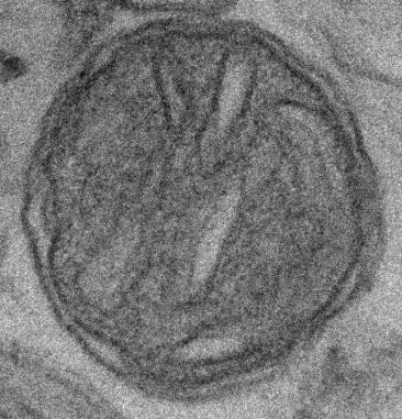 EggPC Mitochondria to rejuvenate eggs