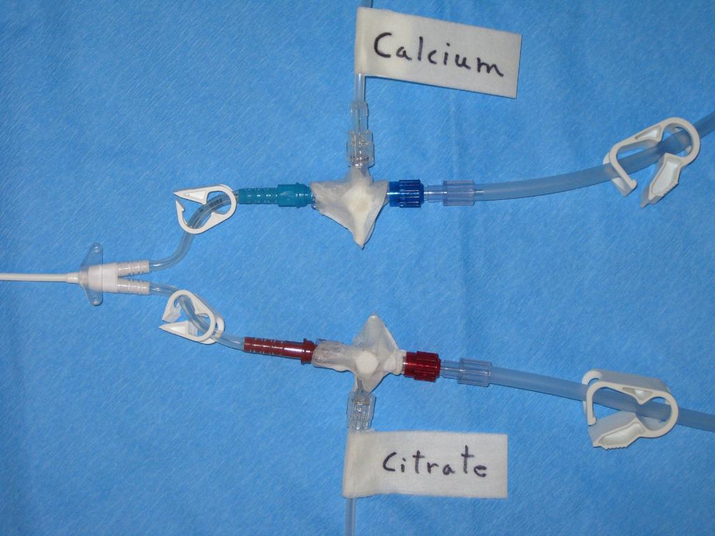 Catheter connections can only be reversed for low blood flow at these points Calcium IV