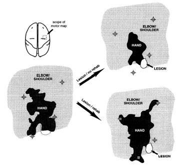 Reprinted by permission from Macmillan Publishers Limited: Remodeling of cortical motor representations after stroke: implications for recovery from