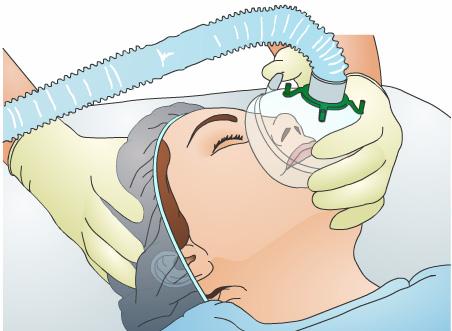 This procedure is usually done under regional, or topical, anesthesia. The eye itself is numbed. General anesthesia could be used to put you to sleep if needed.
