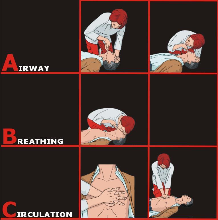 First action in all cases: Check ABCs Airway Breathing Circulation DO NOT leave