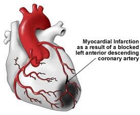 The myocardium depends on a constant supply of oxygenated blood If this blood supply is interrupted even for a short period of time, the myocardium can be