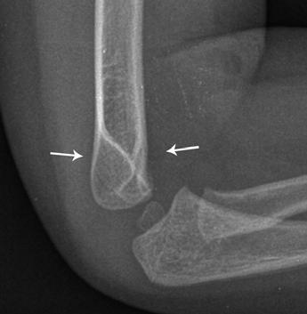 interpretations of the follow-up radiographs, which were used as the reference standard.