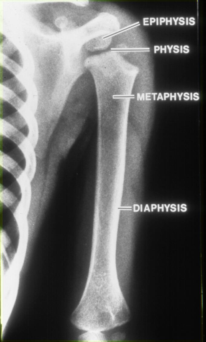 Injury Terms: Fractures Parts of a growing
