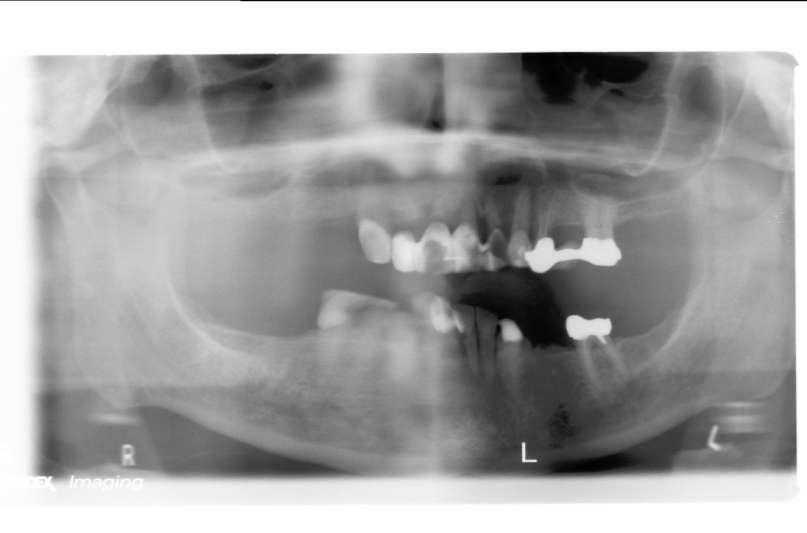 Case 6 Radiographic view