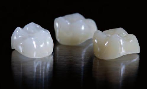 IPS Empress CAD Multi Blocks are available in the five most popular A D and two Bleach BL shades, as well as in 3 sizes. They are ideal for fabricating full and partial crowns as well as veneers.
