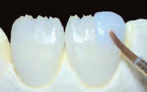 As a result, you will be able to restore the smile of even your most discerning patients.
