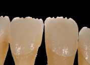 This helps prevent a harsh translucency demarcation line in the incisal third.