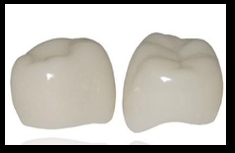 Fine fethered margin of zirconia kinder crown makes the emergence profile for the crown as natural as possible. It is available in two sizes: mid size and regular size.