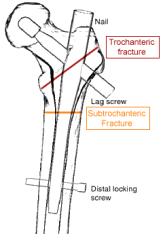 showing anatomical distinction of