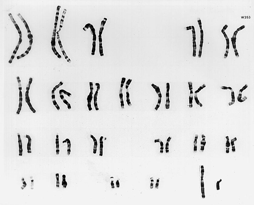 Introduction to Mitosis During mitosis, an existing parent cell divides into two new daughter cells (right). The cells are genetically identical. There is no change in chromosomal number.