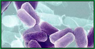 1 - Objectives - Describe salmonellosis and typhoid fever (salmonella) Recognize