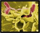 Salmonellosis Definition - Severe lower GI disease Over 40,000 cases 600 deaths