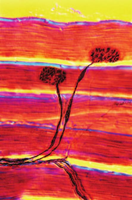 neuromuscular junction neuron muscle Figure 2.5 Neurons send electrical impulses that stimulate muscle contractions.