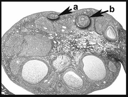 OVARY "A" marks the primordial or primary follicles in both micrographs. "B" is a Graafian follicle with its oocyte.