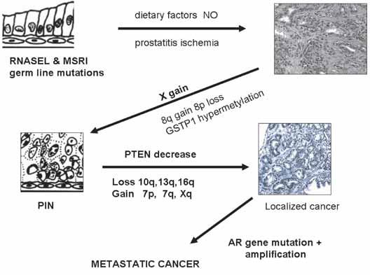 Mikuž G / New discoveries in prostate cancer pathogenesis S125 Figure 2. Hypothetical molecular pathogenesis of prostate carcinoma (modified after Nelson).