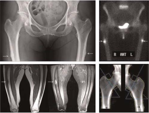 Imaging using other modalities Plain X-rays Bone Scan MRI