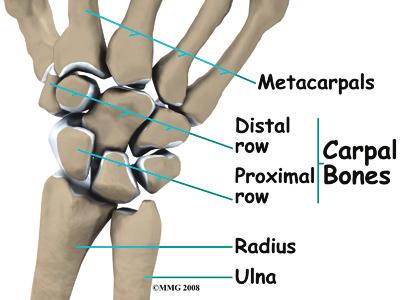 Mild injuries of the triangular fibrocartilage complex may be referred to as a wrist sprain. As the name suggests, the soft tissues of the wrist are complex.