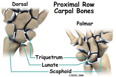 A triangular fibrocartilage complex injury can be a very disabling wrist condition.