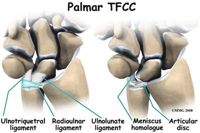 Other parts of the complex include the dorsal radioulnar ligament, the volar radioulnar ligament, the meniscus homologue (ulnocarpal meniscus), the ulnar collateral ligament, the subsheath of the