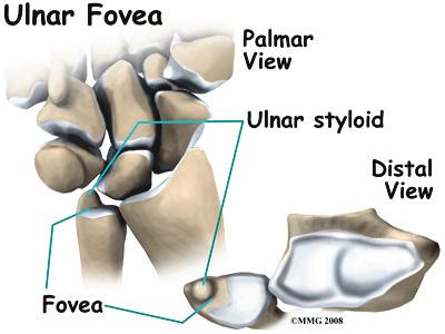 The groove is at the junction of the ulnar bone and wrist.