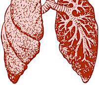 tissues between the air sacs Pleural effusion Pneumonitis