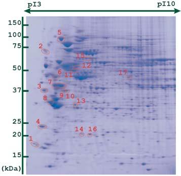 9.2 Phosphopeptide Enrichment Technique Using Ti2 (2) - MALDI-TF MS Fig. 9.2.4 shows the results of electrophoretic analysis of a whole cell lysate with abundant phosphoproteins.