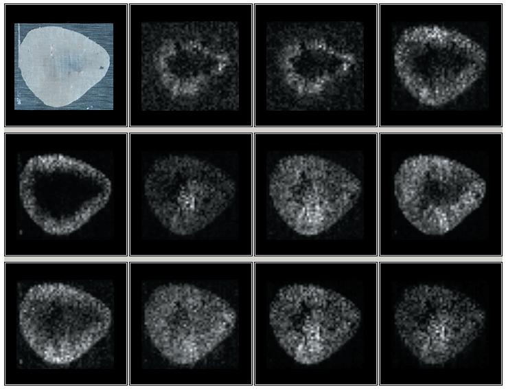 9.8 MALDI Mass Spectrometric Imaging for Peptides/Protein (2) - MALDI-TF MS From the results of Fig. 9.8.2, several MS peaks presumed to be peptides and proteins were detected directly from the tissue.
