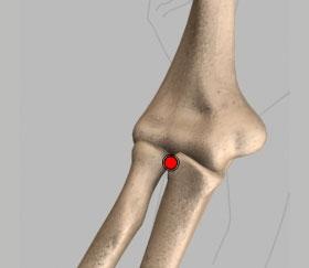 Unit 1: Proximal Radioulnar joint (Fig. 12) Our elbow is held in place and supported by various soft tissues.
