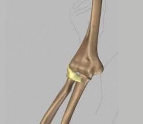 19) Lateral collateral ligament Located on the outside of the elbow this ligament connects the radius