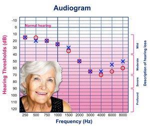 34. What tests can be used to diagnose hearing loss? 35. A patient has been diagnosed with mild hearing loss at frequencies above 1,000 Hz.