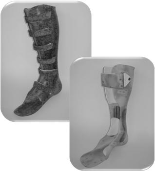 High Risk Stress Fractures Tibial anterior cortex Medial malleolus Talus Navicular Proximal diaphysis of 5 th metatarsal High Risk Stress Fractures May require surgical intervention Immobilization,