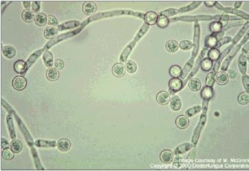 Candidiasis Candida albicans is the most important species of candida (other species ). Candida albicans is oval gram positive budding yeast which produce pseudohyphae.