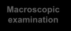 Diagnosis Macroscopic examination Depend on the color of the granules Microscopic examination Septate