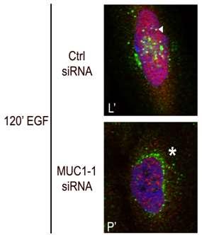- MB-MDA-468 (TN breast cancer cell line) - EGFR = green staining - Presence of EGF and MUC-1 EGFR translocates to the nucleus -