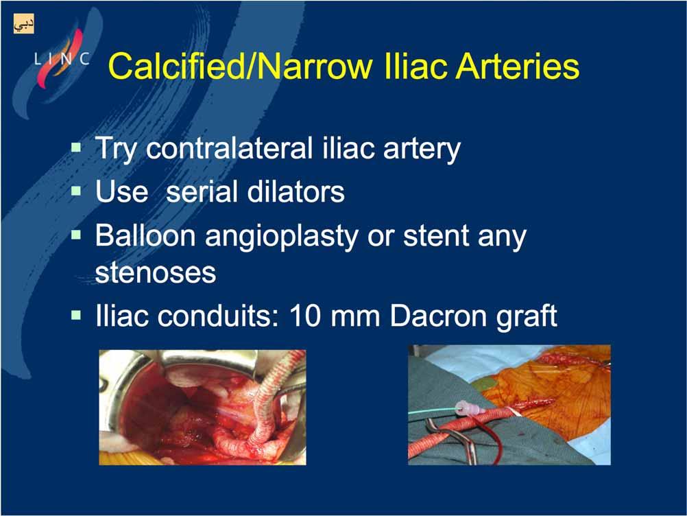 dilators Balloon angioplasty or stent