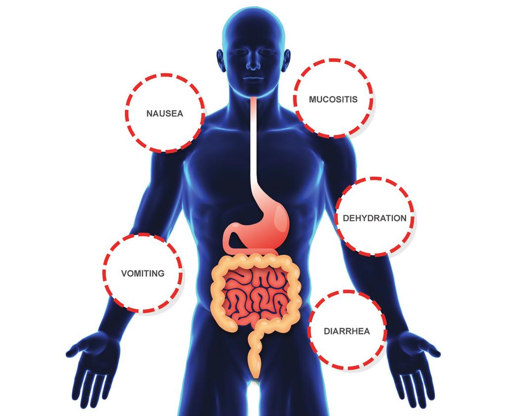 GI effects This image highlights the side effects that may occur in the GI tract from chemotherapy and radiation treatments.