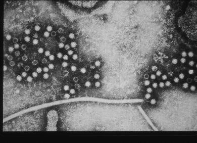 HEPATITIS E VIRUS 1980: recognized as a new virus 1983: identified