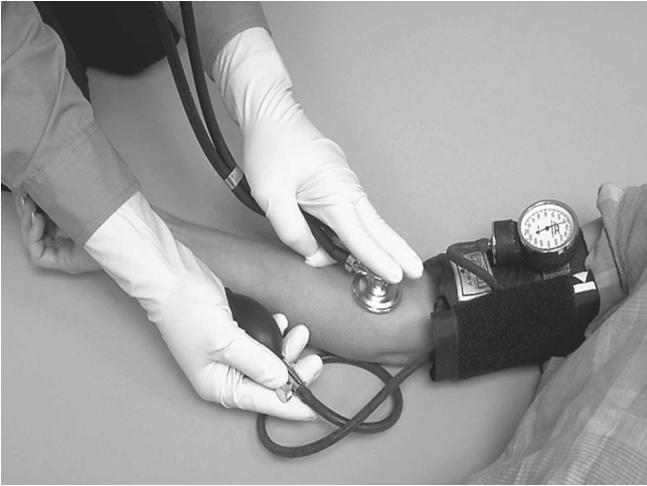 Measuring Blood Pressure Wrap cuff around patient s upper arm Lower edge of cuff placed about 1 inch above crease of elbow Center of bladder placed over brachial artery Assessing Blood Pressure by