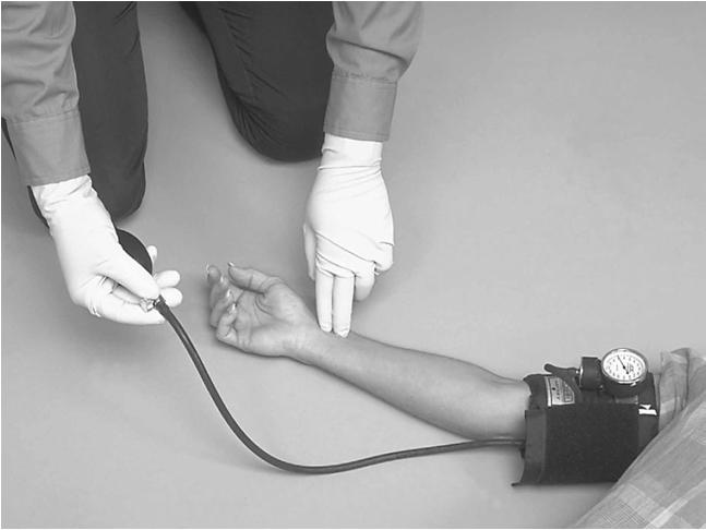 Assessing Blood Pressure by Palpation Position cuff and find radial pulse Inflate cuff