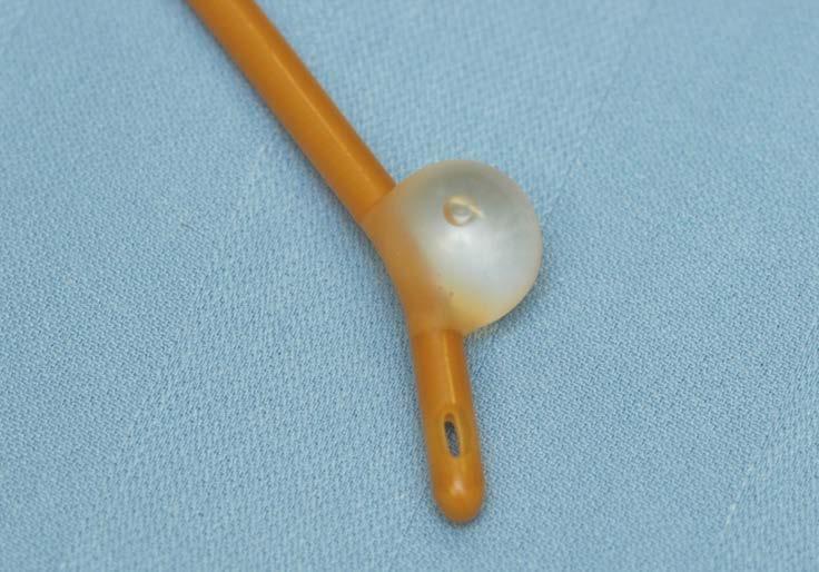 This catheter has a small balloon on the end, which is blown up after the catheter is put in