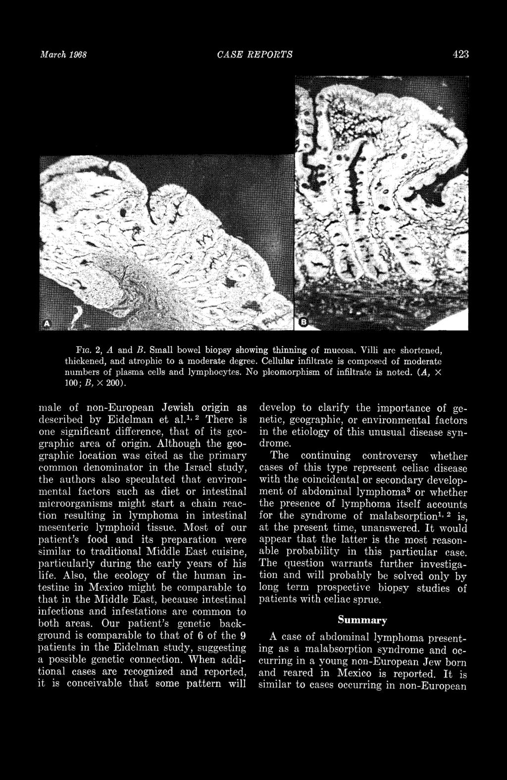 March 1988 CASE REPORTS 423 FIG. 2, A and B. Small bowel biopsy showing thinning of mucosa. Villi are shortened, thickened, and atrophic to a moderate degree.