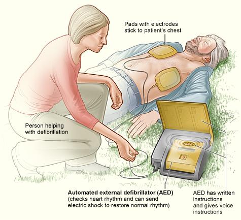 Automated External Defibrillators Can be used for sudden cardiac arrest