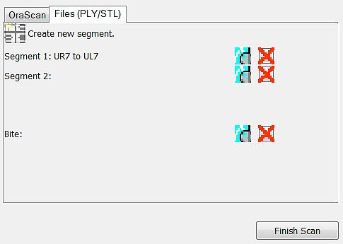 Import STL Files for Supplemental Scans 1. Select the Files (PLY/STL) tab. 2. Under the tab, click the Create/Preview/Edit icon adjacent to the segment name (such as Segment 1). 3.