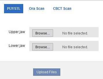 Import STL Files for Diagnostic/Final Scans 1. For Upper Jaw, click the Choose File button, select the patient s upper scan file and click Open. 2.