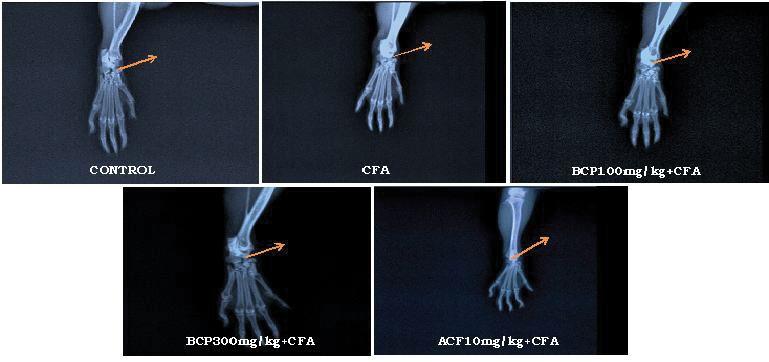 Journal of Bone Reports & Recommendations Figure 7 Radiology of Hind Paws in Adjuvant Induced Arthritic Rat.