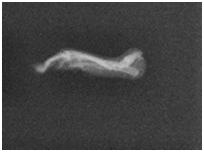 Fig 4: Showing the X-ray of hind paws of vehicle, arthritis control,