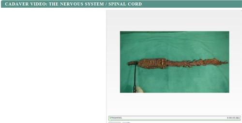 Activity 2: Cadaver Video: Cadaver Video: The Nervous System/Spinal Cord Navigation: WileyPlus > Read, Study, & Practice > Chapter 15.