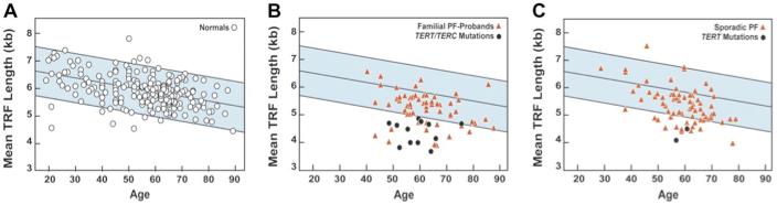 TERT and TERC mutations associated with FIP Mutations TERT and TERC (TR) in familial interstitial pneumonia Mutations associated short telomeres Short telomeres in 25% familial and